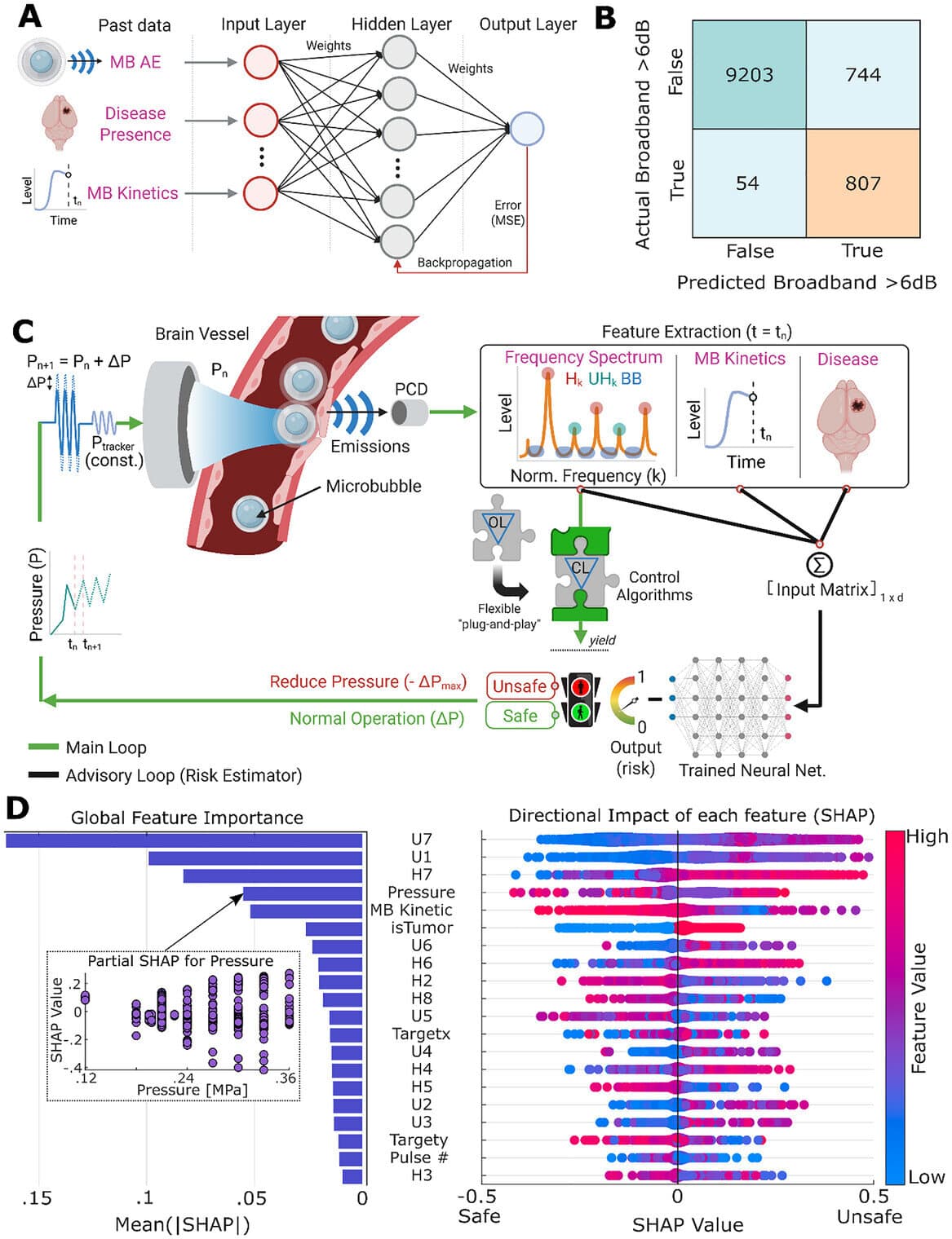 AI-guided ultrasound improves blood-brain barrier opening procedures by predicting bubble collapse